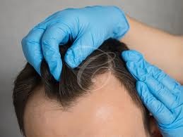 Hair Treatment